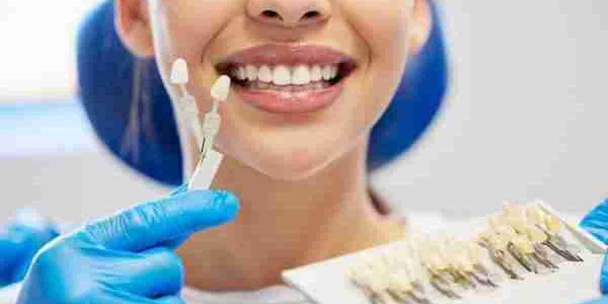Smile Symmetry and Whitening: The Overlooked Connection