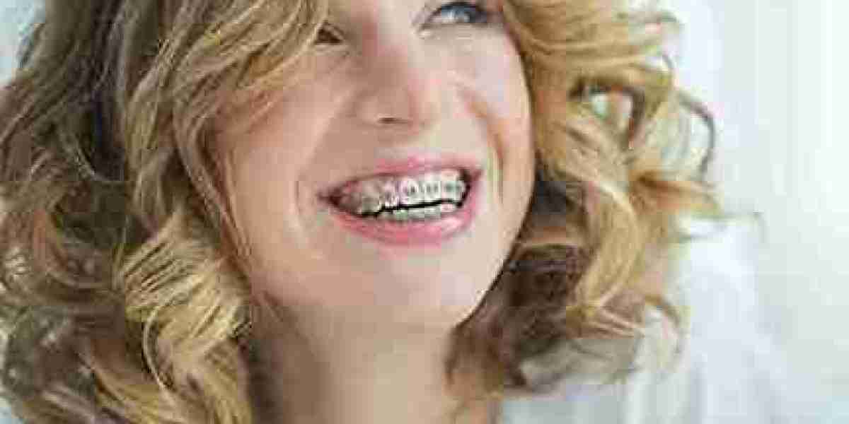Slight Ache and Grinding Habits While Wearing Invisalign