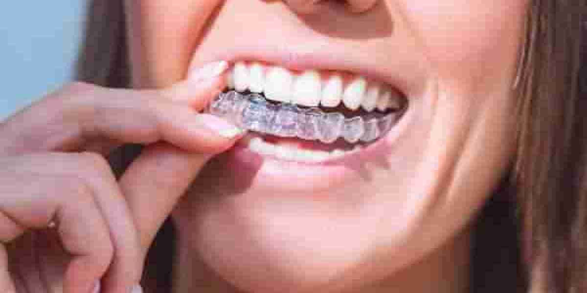 Modern Smiles Start with Nearly Invisible Aligners