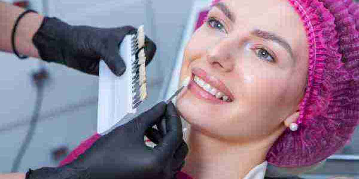 Is Charcoal Toothpaste Truly a Whitening Agent?